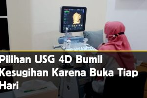 USG 4D Kesugihan Buka Tiap Hari? Klinik Gomem Patikraja Solusinya!