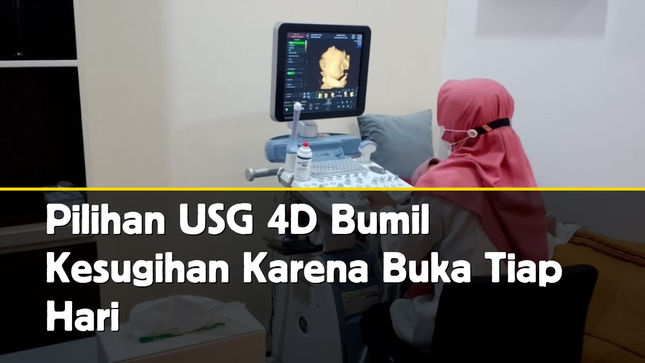 Pilihan USG 4D Bumil Kesugihan Karena Buka Tiap Hari