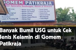Penasaran Jenis Kelamin Bayi? Cek USG di Gomem Patikraja, Banyumas!